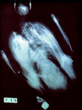 X-ray of pink-footed goose with embedded shotgun pellets